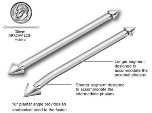 Arrow-lok product photo illustration.