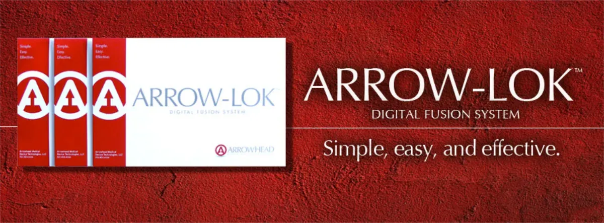 Arrow-lok Digital Fusion System. Simple, easy and effective.